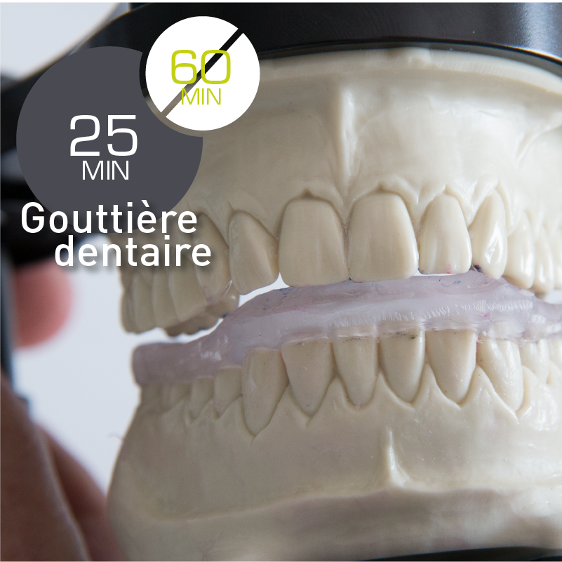 Gouttière dentaire - Trasformer System